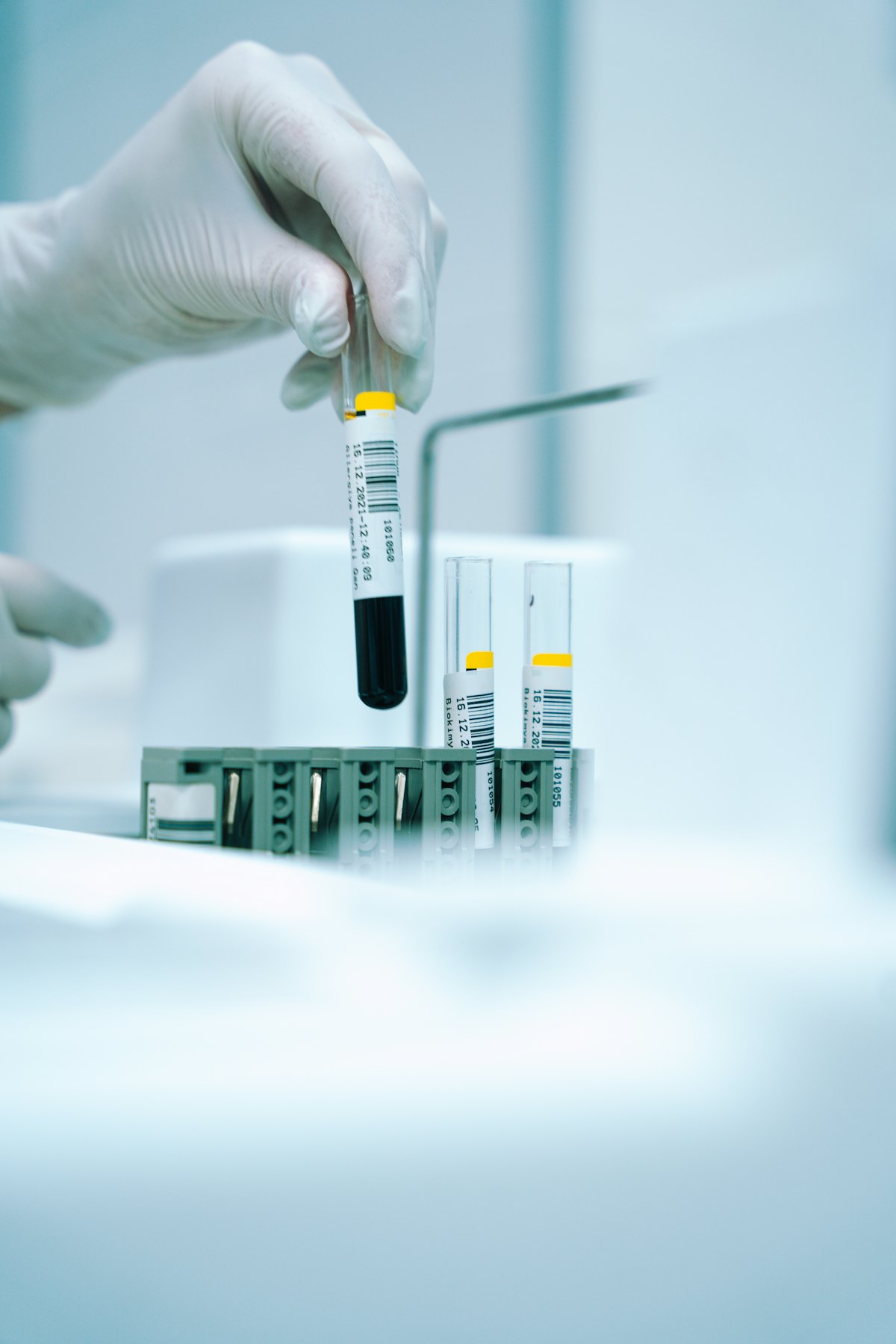 Blood sample tubes prepared for PRP therapy