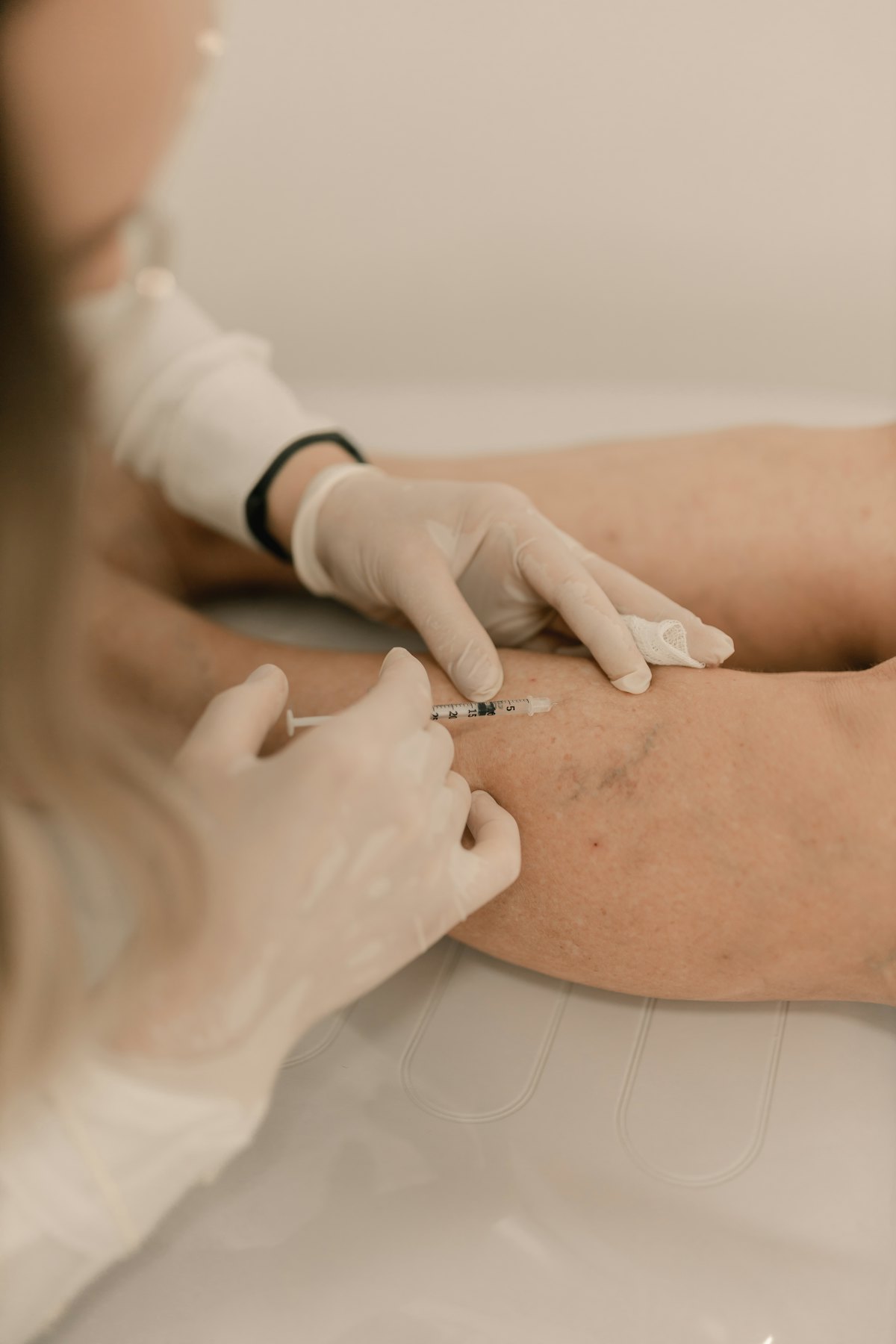 Doctor performing a small skin procedure on the arm